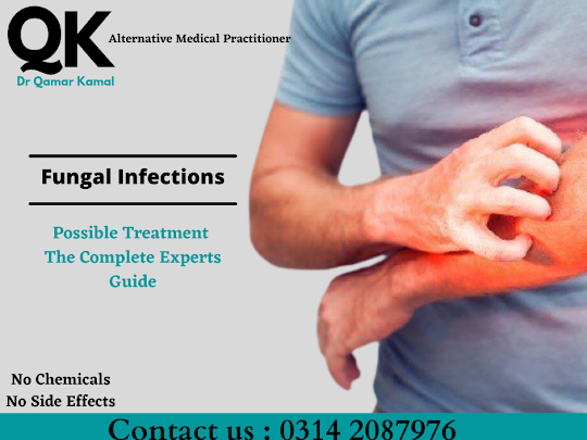 Best homeopathic doctor in karachi for fungal infection treatment